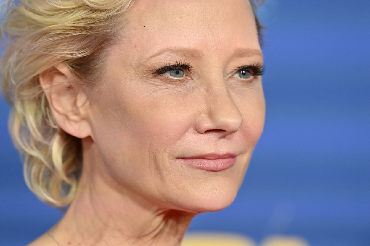 Meghalt Anne Heche