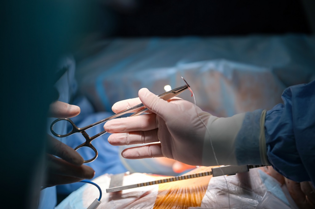 Szervátültetés: 307 sikeres műtét volt tavaly Magyarországon